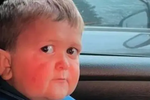 Ile lat ma Hasbulla? Zaskakujące fakty o jego życiu i popularności