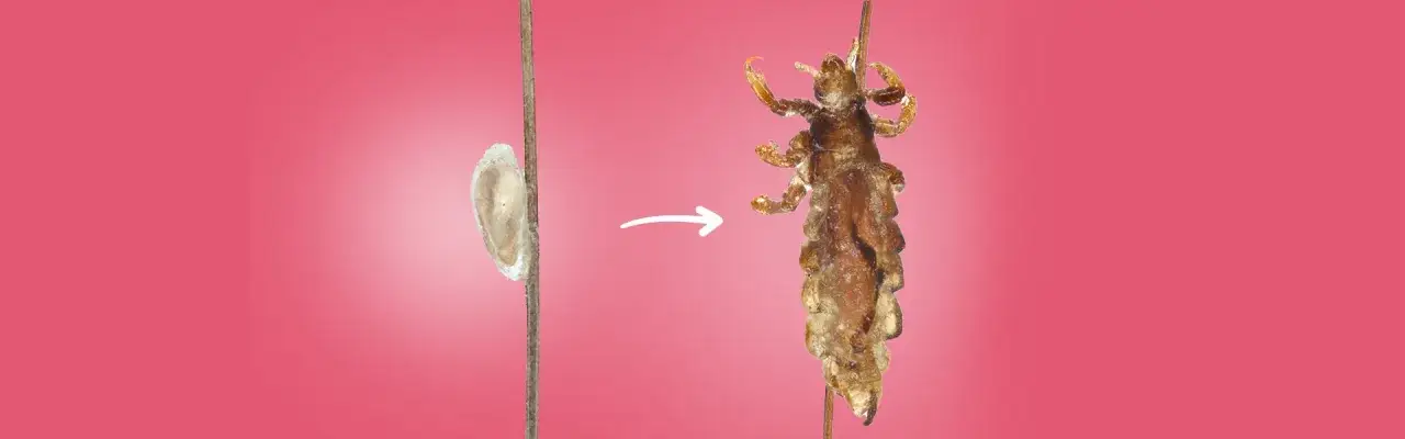 Zdjęcie Skąd się wzięła pierwsza wsza? Fascynująca historia ewolucji wszy